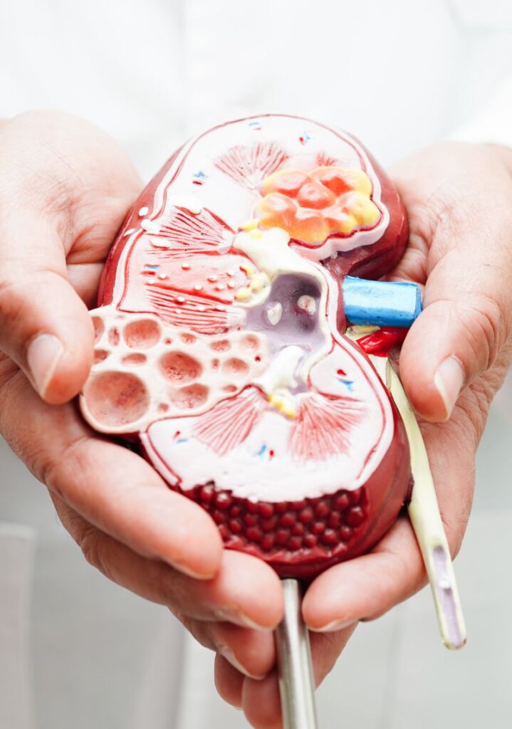 Urólogo en Guatemala 2